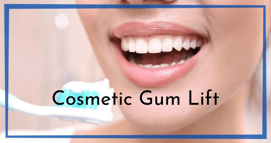 Cosmetic Gum Lift Chesapeake VA