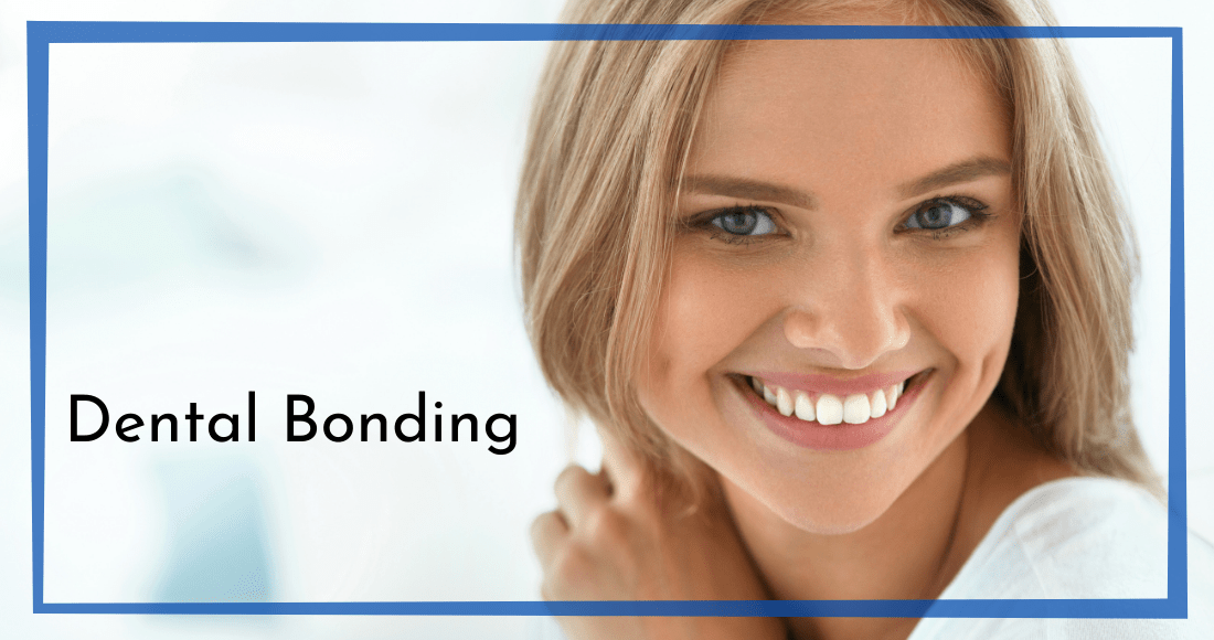 Dental Bonding Chesapeake VA Chesapeake Virginia Dentist