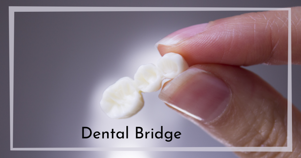 Dental Bridge Chesapeake VA