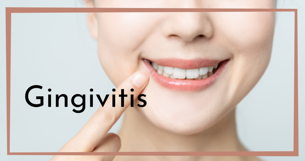 Gingivitis Chesapeake VA