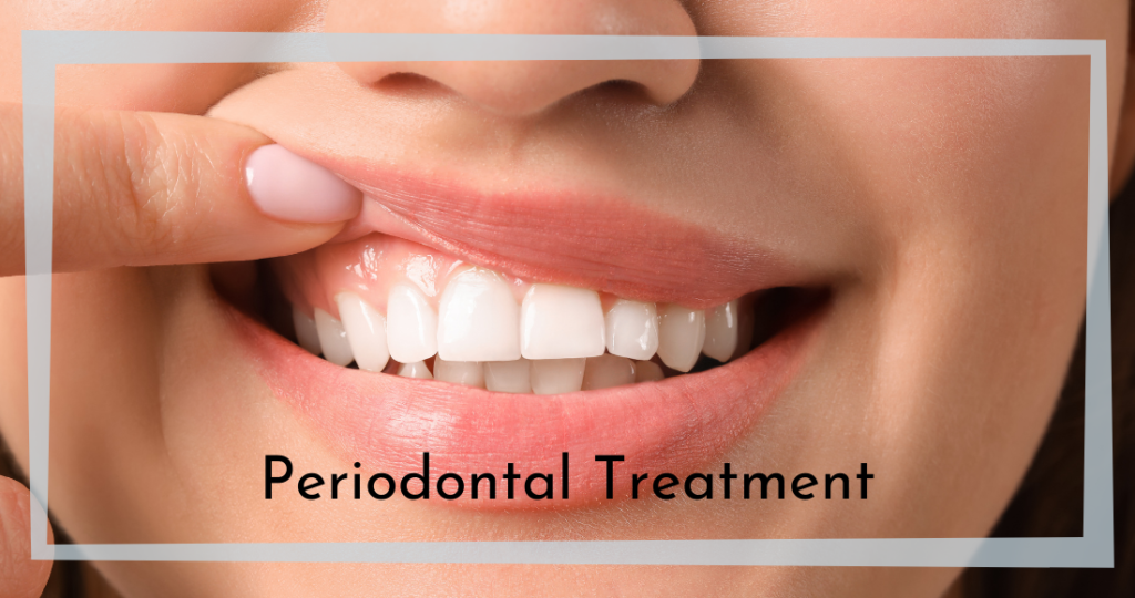 Periodontal Treatment Chesapeake VA