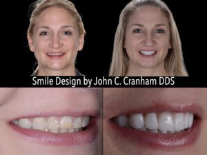 Chesapeake Center For Complete Dentistry Case Study