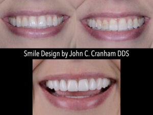 Chesapeake Center For Complete Dentistry Case Study