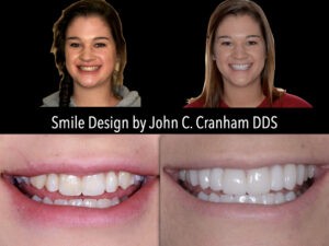 Chesapeake Center For Complete Dentistry Case Study