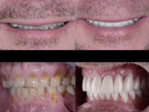 Chesapeake Center For Complete Dentistry Case Study