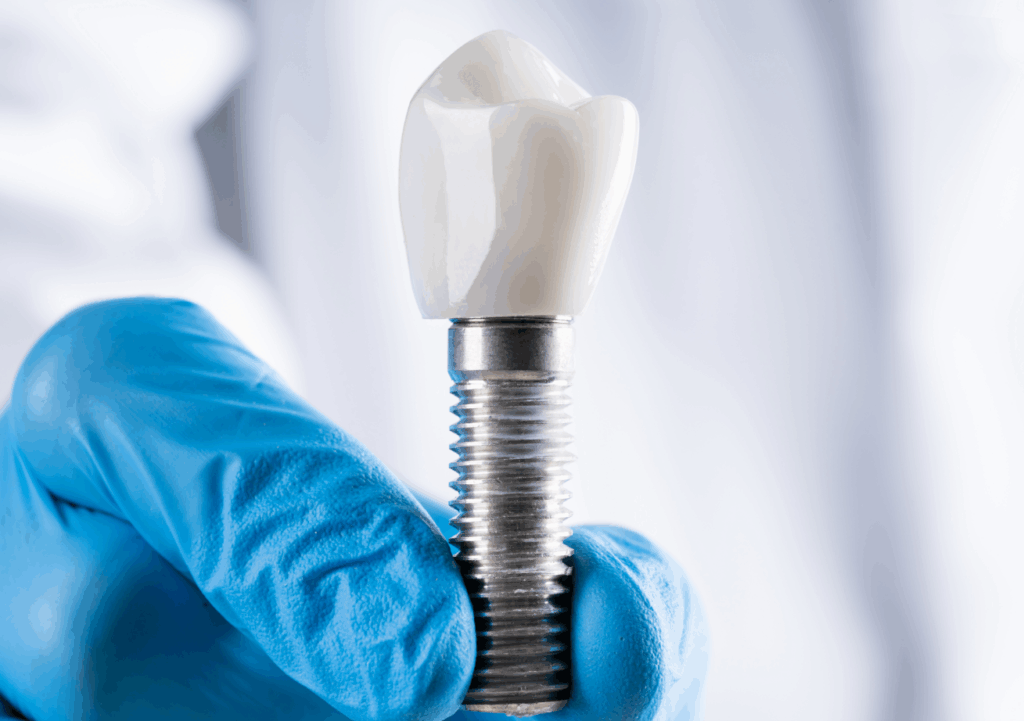 dental_implants_Chesapeake_implant_dentist