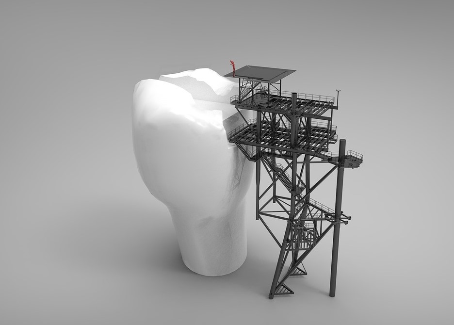 CEREC_Chesapeake_dentist