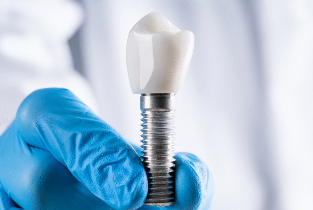 Chesapeake_dental_implants_dentist